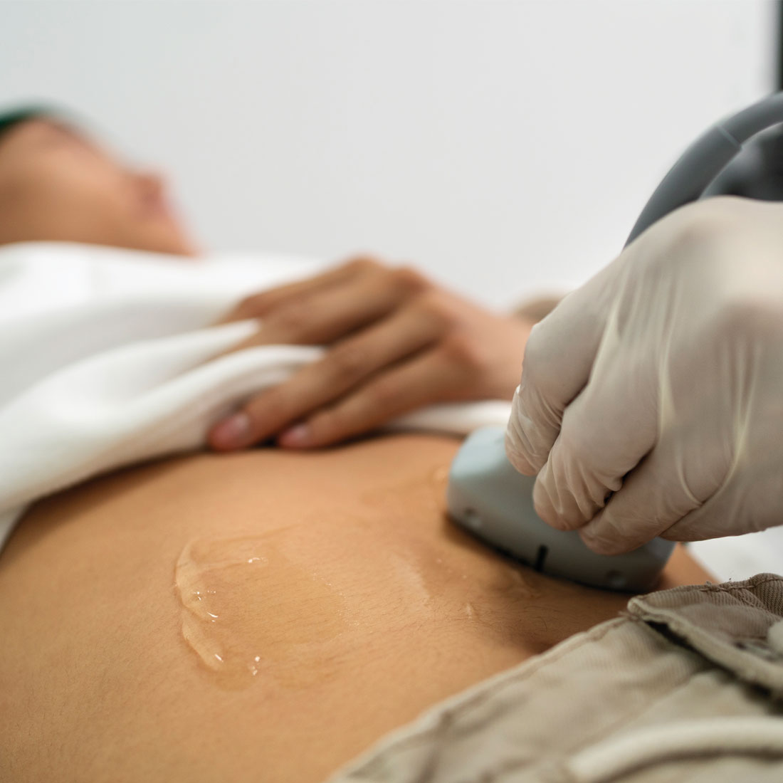 General Ultrasound in Luton